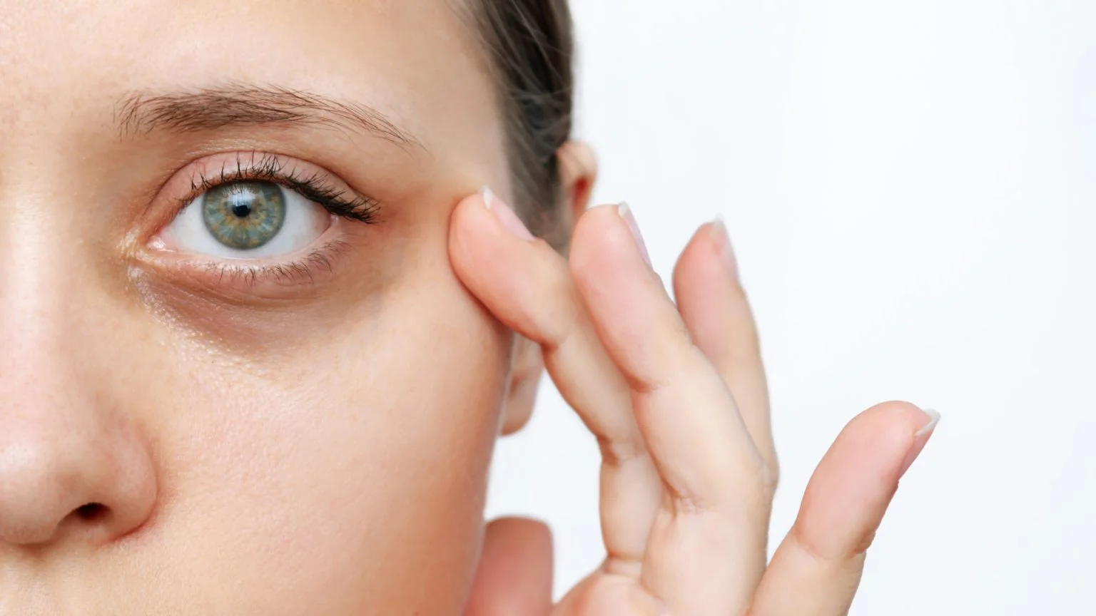 Under Eye Dark Circle Treatment